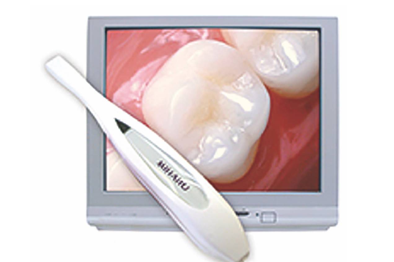 Intra-Oral-Camera