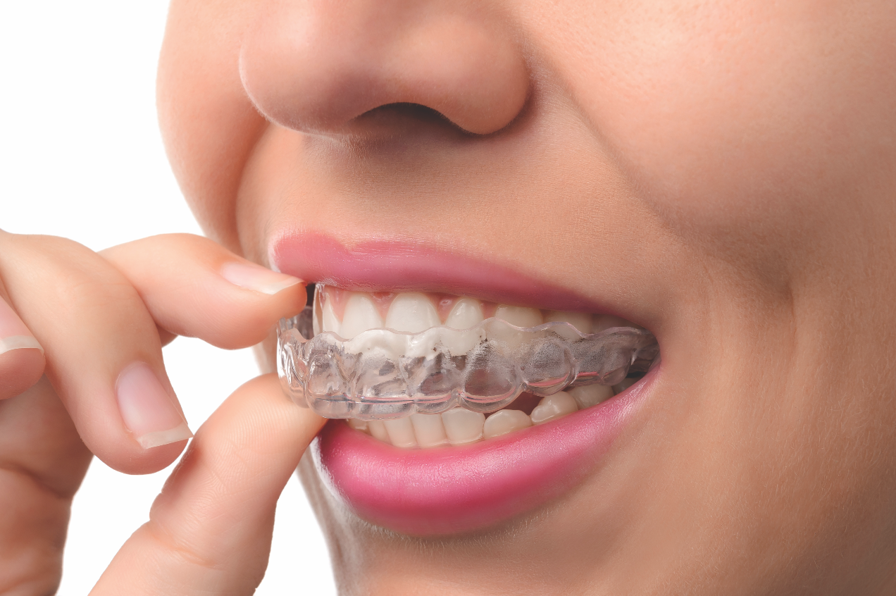 wear-invisalign-with-confidence